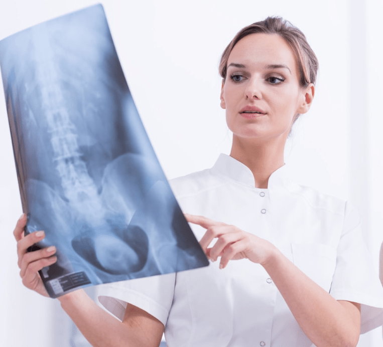 Rindkere osteokondroosi diagnoosimine röntgenuuringuga